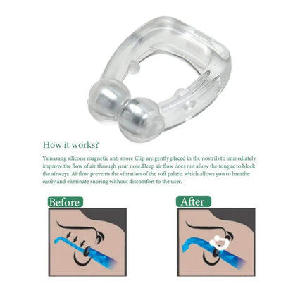 Nasal Slence